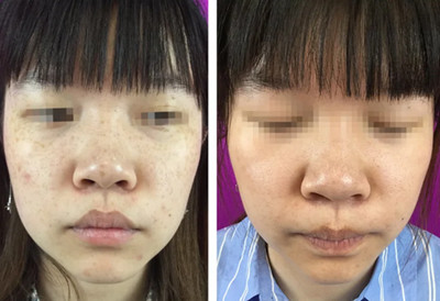 ��������L���ļ��t(y��)Ժ���^��