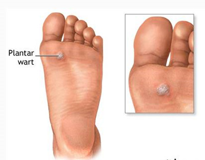 ������(hu��)����(hu��)��Ⱦ