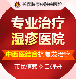 長春在線免費咨詢皮膚科:大腿椰子濕疹怎么回事
