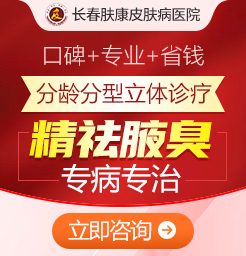 長(zhǎng)春膚康皮膚醫(yī)院解惑狐臭會(huì)一直遺傳下去嗎